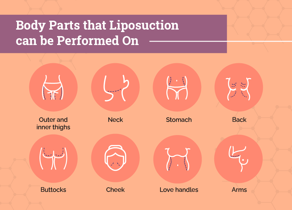 Liposuction in Singapore 101: What, Why, Where and How Much?