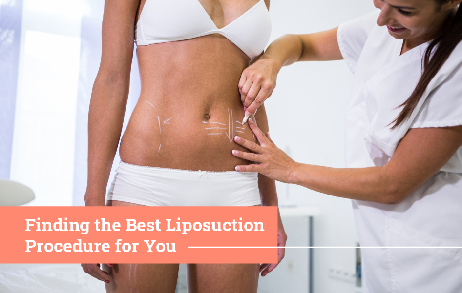 Everything you need to know about Liposuction in Singapore